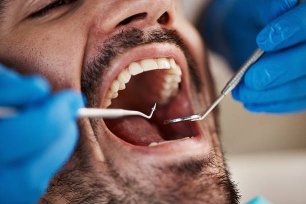 Best Emergency Treatment for Dental Infections or Abscesses in Hurleyville, NY